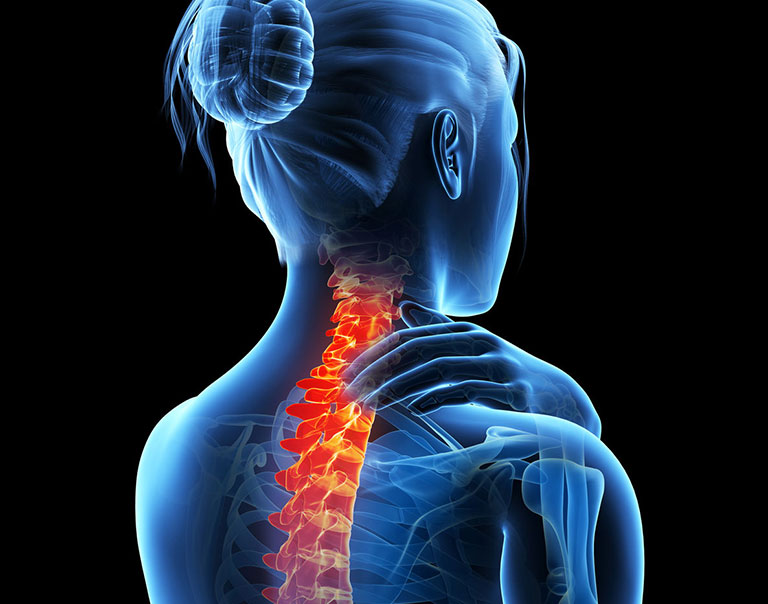 Neuro Sports Performance and Rehab - Whiplash Relief