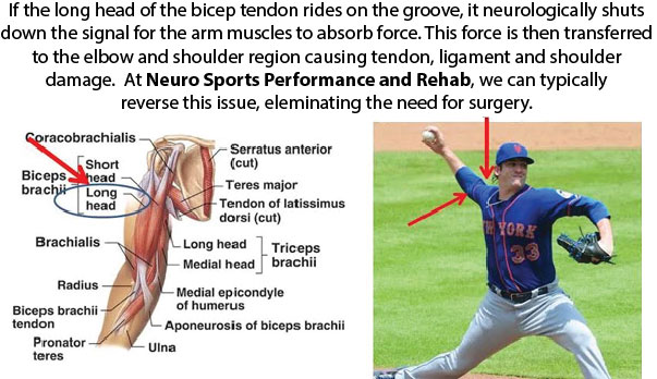 Neuro Sports Performance and Rehab - Eliminate Tommy John Surgery